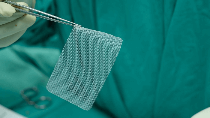 Columbus hernia mesh lawyer